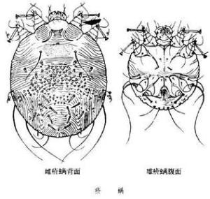 疥螨