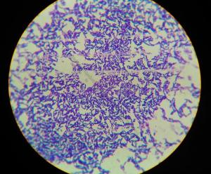 革兰氏阳性细菌细胞壁图片