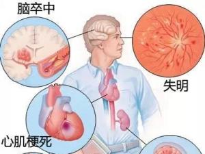 高血压的危害