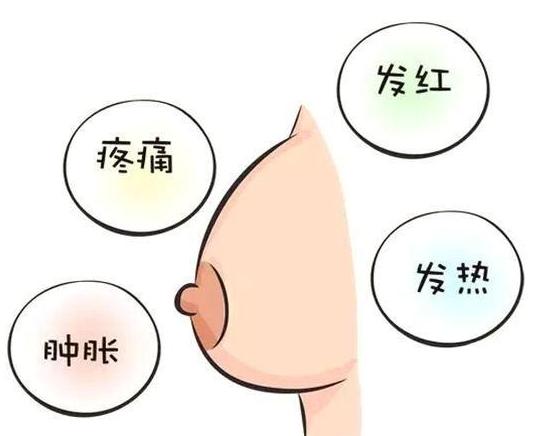 什么时候才能不涨奶不堵奶 0