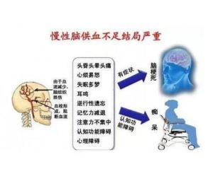 脑供血不足最佳治疗方法（脑供血不足最佳治疗）