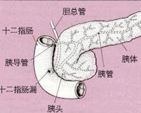 胰头癌 - 搜狗百科