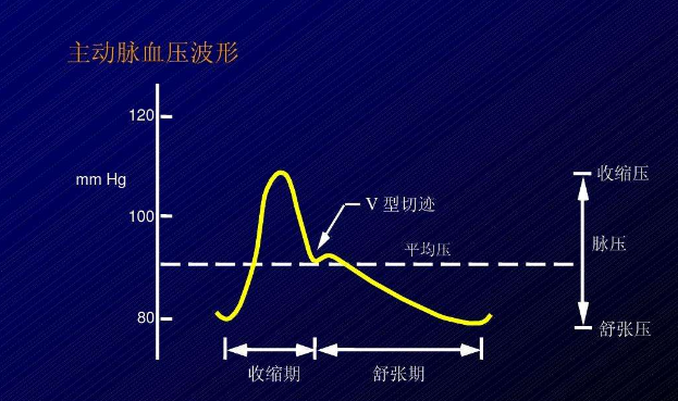平均动脉压