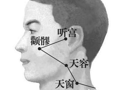 天容穴是手太阳小肠经上常用的腧穴之一,在下颌角