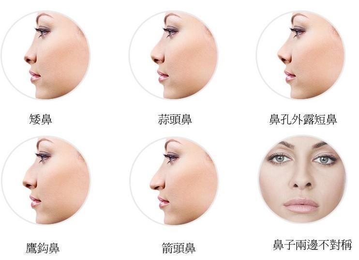 什么是水滴形鼻子 0