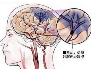 交感神经兴奋