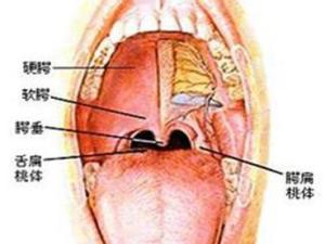 扁桃体发炎