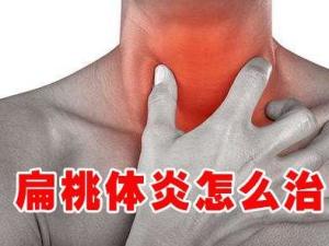 扁桃体发炎