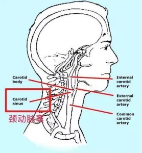 颈动脉窦位置图片