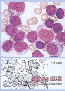 淋巴细胞