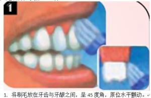 水平颤动法(又称Bass法)