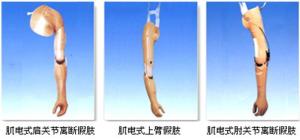 假肢