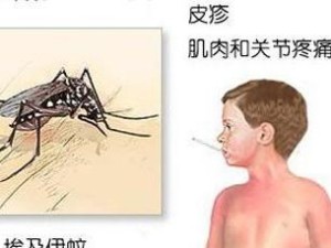 登革热相关图片