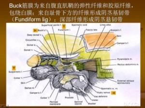 阴茎延长术