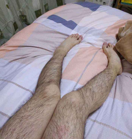 腿毛