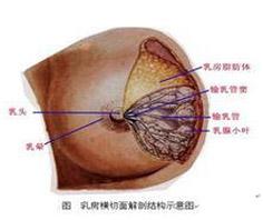 乳腺导管扩张症