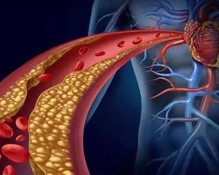 高密度脂蛋白是什么蛋白 0