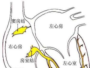 窦房结的位置图片