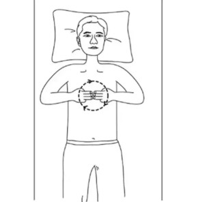 心窝部(2)心窝部,是心脏窝所在位置,即心口部,也就是胸骨剑突(护心骨)