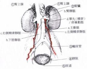 精索静脉曲张高位结扎术