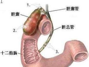 十二指肠球炎