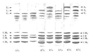 等电聚焦检测的ApoE表型 等电聚焦检测的ApoE表型