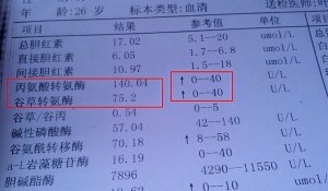 转氨酶偏高