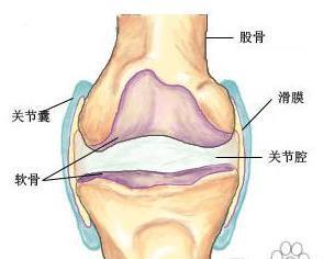什么情况会造成膝盖积液 0