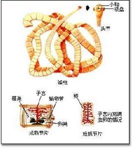 猪囊尾蚴(cysticercus cellulosae)指猪肉绦虫(taenia solium)的