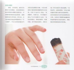 爱灸