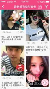 真优美APP-美容整形案例