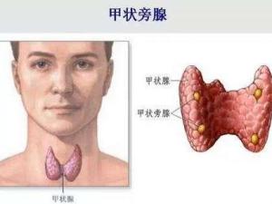甲状旁腺