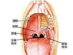 声带癌的早期症状图片图片