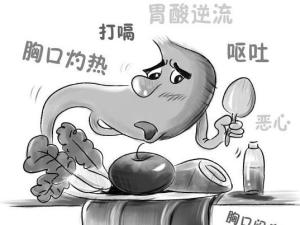 胃反酸