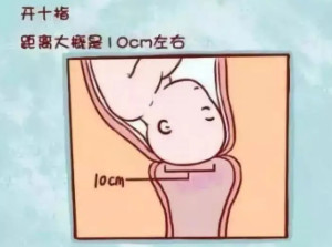 开宫口