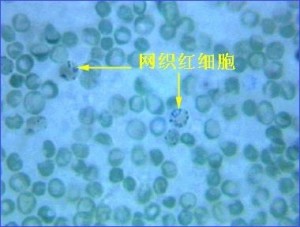 网织红细胞