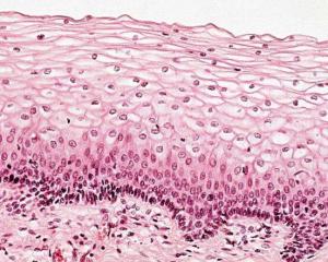 复层扁平上皮细胞图图片