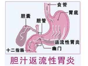 病症例