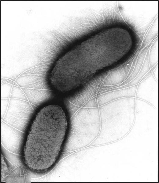 痢疾杆菌画图图片