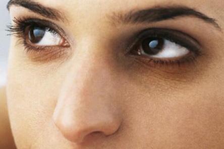 黑眼圈 生理现象 搜狗百科