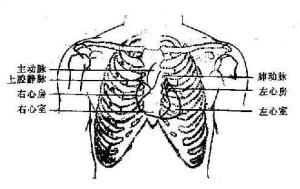 肋软骨炎痛点示意图图片