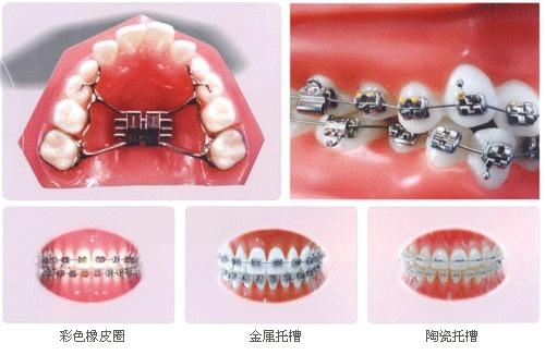 颊面管的作用图片