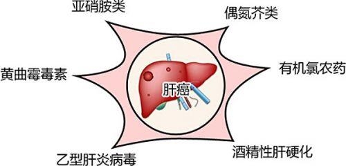 肝癌