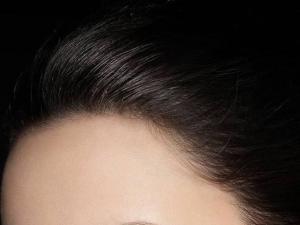 发际线调整 发际线调整