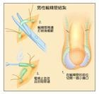 射精疼痛