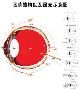 弱视眼 搜狗百科