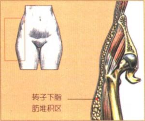 女性髋部最宽点在转子下脂肪堆积区
