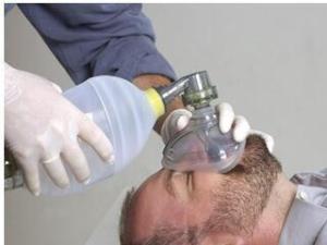 简易呼吸器