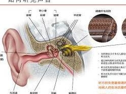 突发性耳聋