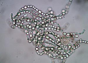 鱼腥藻4编辑2形态特征鱼腥藻多种鱼腥藻鱼腥藻鱼腥藻(5)本属中有34种